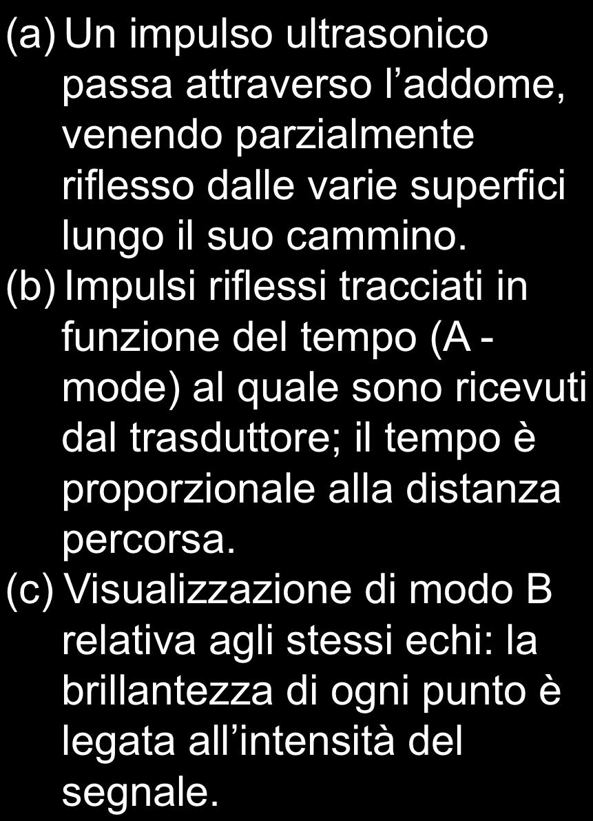 ULTRASUONI (a) Un impulso ultrasonico passa attraverso l addome, venendo parzialmente riflesso dalle varie superfici lungo il suo cammino.