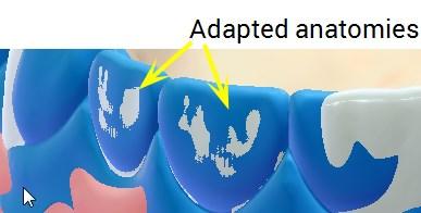 visualizzato in blu e viene indicato come wax-up diagnostico. 1.