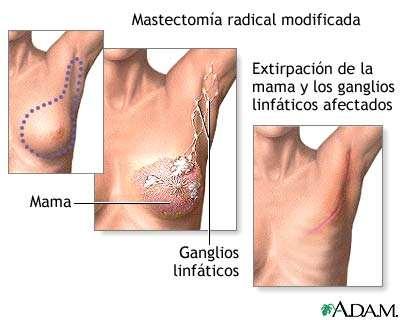 ogni 5 anni Carcinoma del