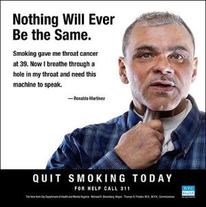 Niente sarà più uguale. Il fumo mi ha regalato un cancro alla gola a 39 anni.