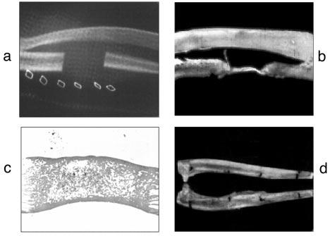 Fig. 1. Capacità osteoinduttiva di OP-1/collagene valutata su difetti segmentali critical size di ossa lunghe nei primati (per gentile concessione di S. Cook).