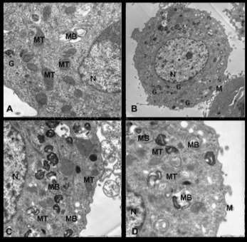 A: untreated cell; B,C,D: cells treated for 72 h PM + ALL.