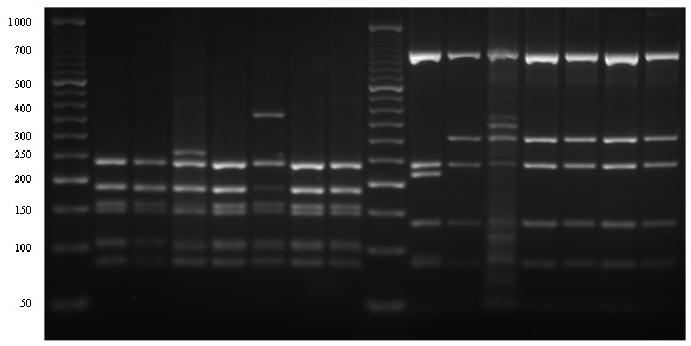 Toxoplasma gondii Prodotti di amplificazione mediante PCR di HCV-RNA dopo elettroforesi su gel di agarosio.