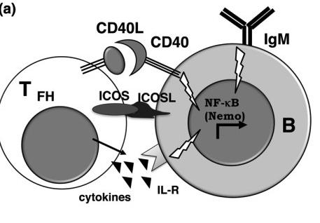 Sindrome da IperIgM causata da difetti nella interazione CD40-CD40L A l t e r a z i o n i n e l l a segnalazione del CD40 o la mancata interazione con il CD40L sono alla base della sindrome da