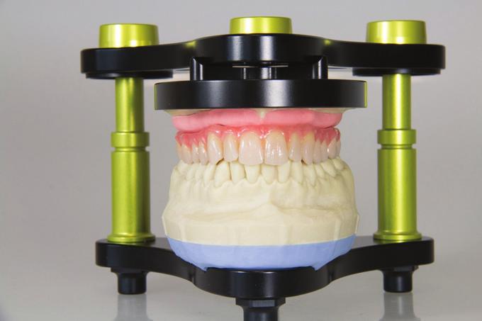 Capovolgere la muffola e iniettare nella ASE () il Gingiva Flow per creare la mucosa. Prepolimerizzare con la New Light ox con il programma 2 (60s luce).