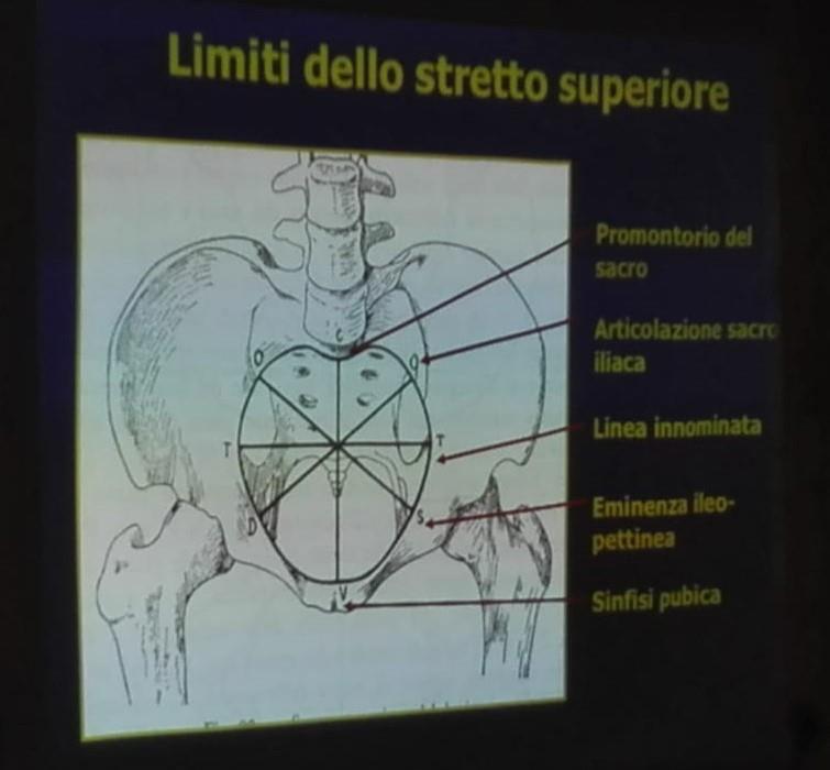 L ingresso pelvico non è altro che il contorno del cuore di carta da