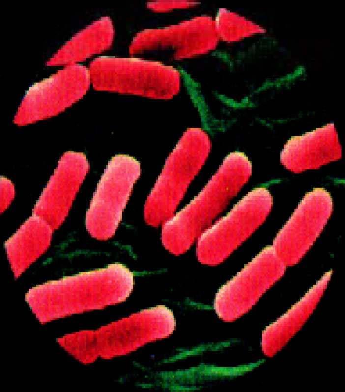 BATTERI COMUNI Escherichia coli 0157:H7 E stato identificato come causa di malattia per la prima volta nel 1932.
