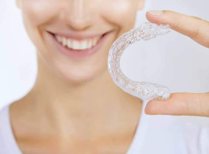 QUANTO DURA IL TRATTAMENTO INVISALIGN?