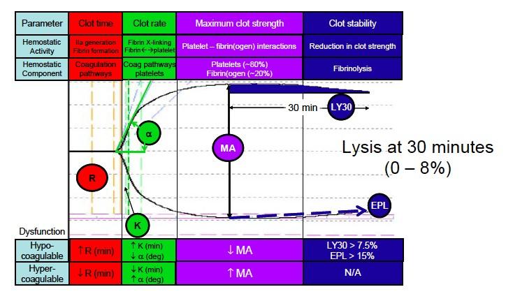 uno stato di ipercoagulabilità se maggiore del range. Fornisce quindi un giudizio globale di normo o ipo o iper coagulabilità. 32 6. Un ultimo parametro importante nella tromboelastografia è il CLI.