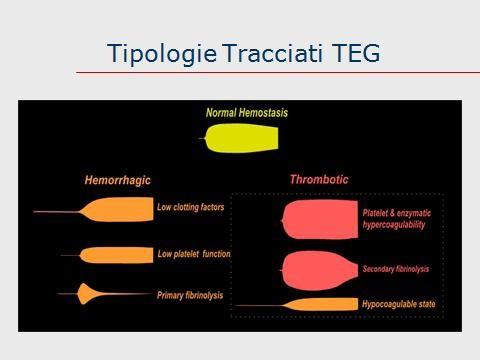 3.3 Tracciati significativi del TEG Un quadro dei possibili tracciati TEG è rappresentato dalla seguente