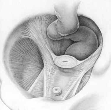 Cervix DeLancey, 2002 45 46 ANATOMIA DEL PAVIMENTO PELVICO