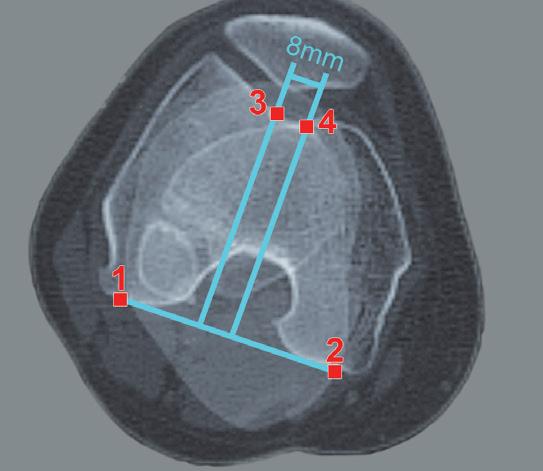 Miglioramenti al modulo trauma Piastre di piegatura Funzione report migliorata medicad Logistics Generazione di requisiti in medicad durante la pianificazione Comunicazione dei requisiti al