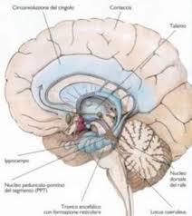 amiloidi (aggregati dendritici, assonali e gliali in una sostanza proteica detta amiloide), matasse neurofibrillari Atrofia corticale