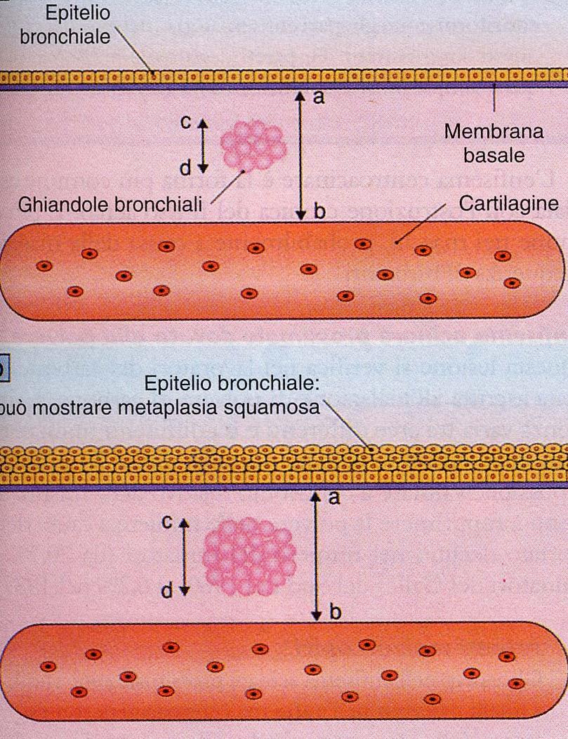 ab = wall cd = gland