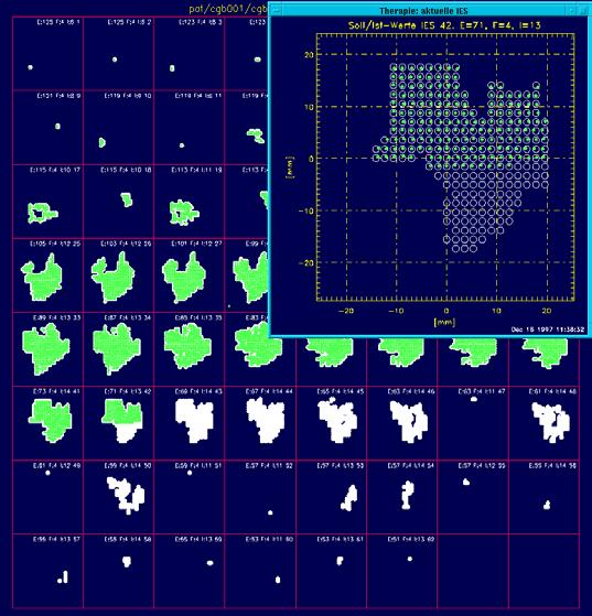 voxel: spill lungo Necessità di