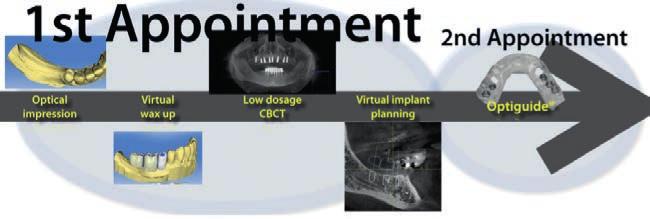 I visita II visita III visita IV visita V visita VI visita VII visita VIII visita Impronta in alginato Laboratorio odontotecnico Prova della dima radiografica TAC o CBCT Valutazione TAC