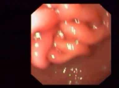Stomaco dei monogastrici Nei Monogastrici all esofago fa seguito un solo sacco, lo stomaco,