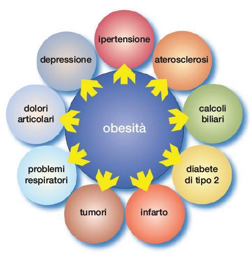 Malattie correlate all obesità L obesità è una delle patologie più