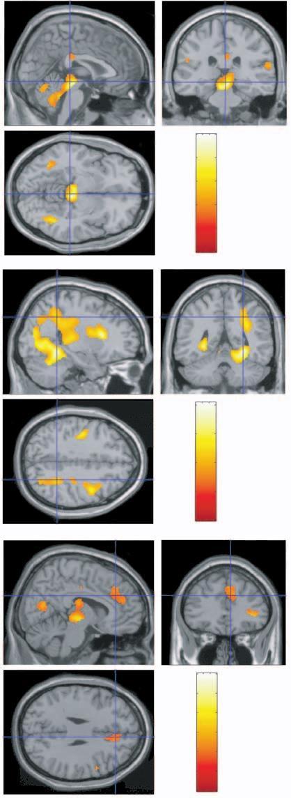 attivazione aree corteccia parietale Sistema Esecutivo (o