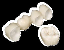 ZENOSTAR Denti monolitici come concetto del futuro E possibile realizzare corone e ponti senza rivestimento, in ceramica integrale in un unico pezzo.