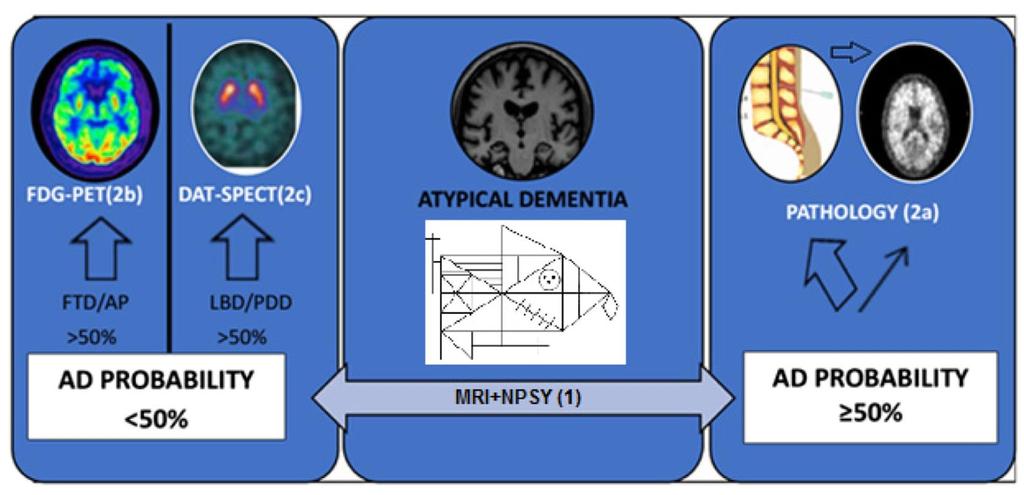 Proposta di un percorso diagnostico AD: D. di Alzheimer; FTD: D.