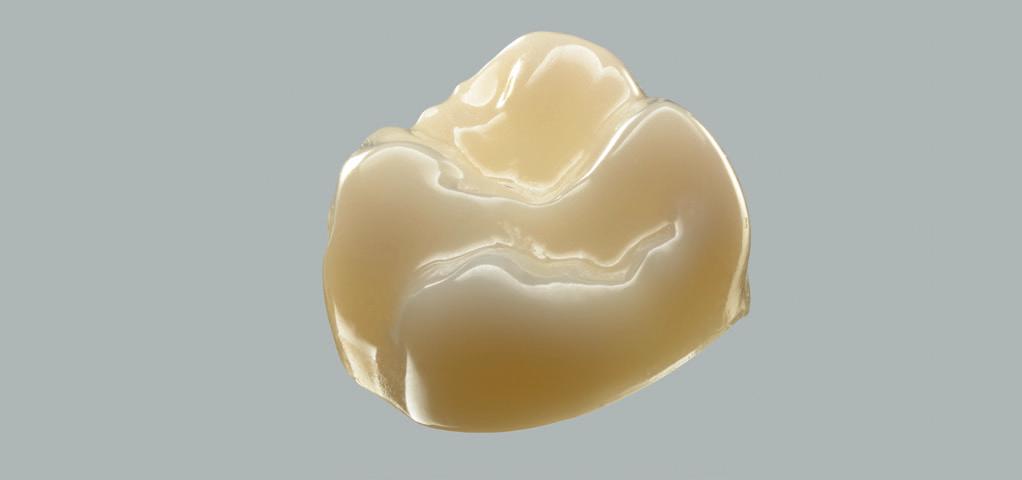 Bleach A1 A2 A3 A3.5 B1 C1 D2 Immagine alla luce UV di corone in 3M Lava Esthetic Zirconia sinterizzata, tinte Bleach, A1, A2, A3, A3,5, B1, C1 e D2. Fonte: dati interni 3M Oral Care. Traslucenza.