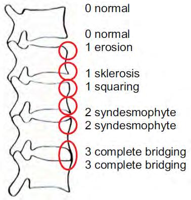 (msasss) per vertebra in women