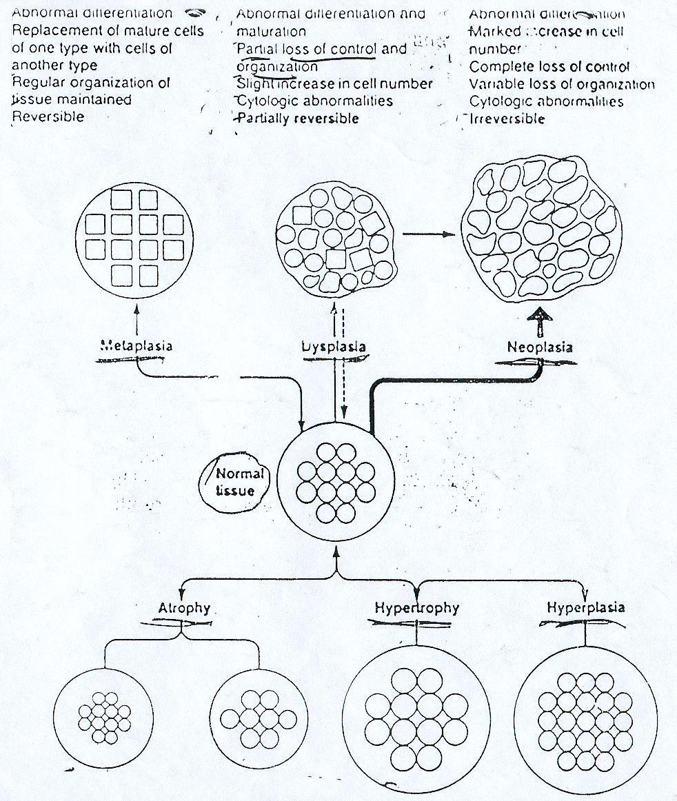 Sostituzione di cellule di un tipo con cellule di un altro tipo. Mantenimento della normale architettura tessutale. Reversibile Differenziamento e maturazione anomale.