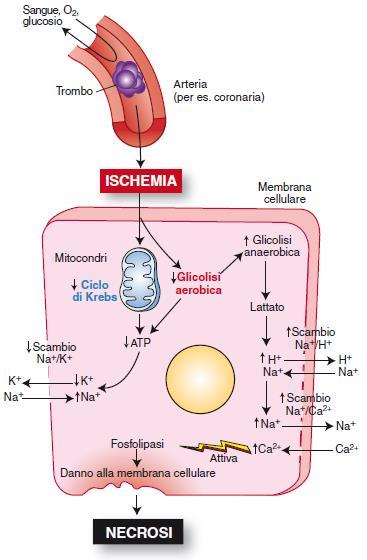 L occlusione di un vaso arterioso determina ischemia al tessuto.