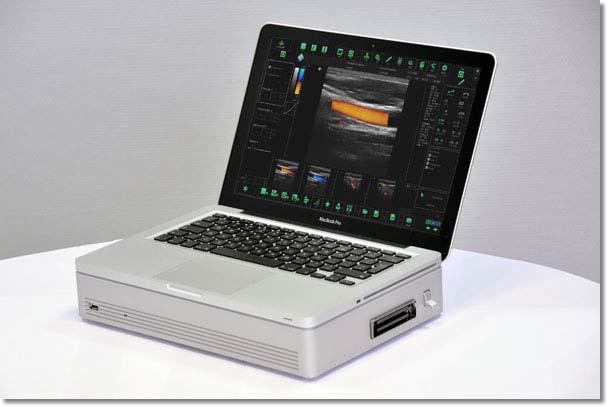 ClarUs Color Doppler Digital Ultrasound Diagnostic System INFO ll ClarUs è un sistema Eco Color Doppler ad alte prestazioni, portatile, compatto e leggero con architettura PC based software driven.