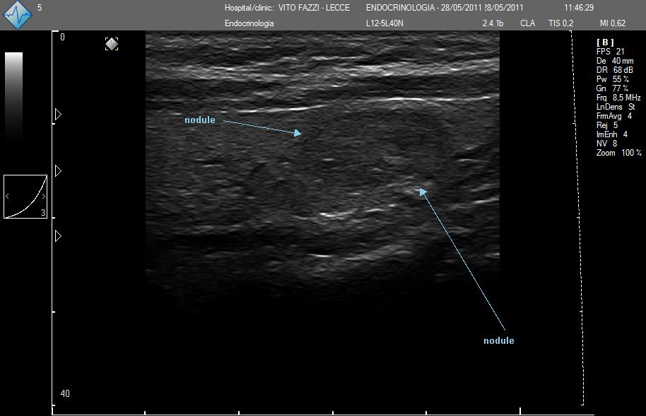 Il NeatView rappresenta l eccellenza per l esplorazione diagnostica