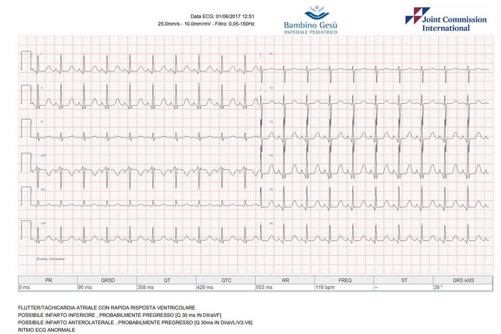 Obiettivi e destinatari del lavoro OBIETTIVI DI PROGETTO Revisione del processo di consulenza ECG (interni, ambulatorio, emergenza).