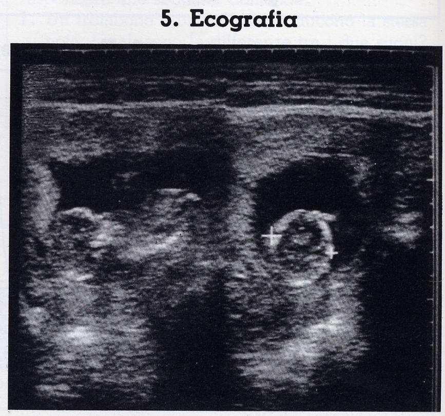 Sulla riflessione del suono si basano L ecografia Che è una tecnica diagnostica in cui uno strumento invia fasci di ultrasuoni sulla parte del corpo da esaminare.
