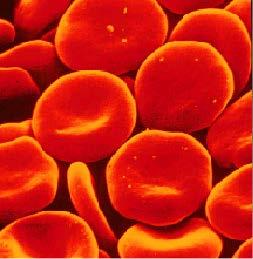 Eritrociti umani erythos = rosso kytos = contenitore cavo Disco biconcavo senza nucleo e mitocondri contenente 3x10 8 molecole di emoglobina Concentrazione di Hb nel sangue: 5-10 mm (circa 15 g/100