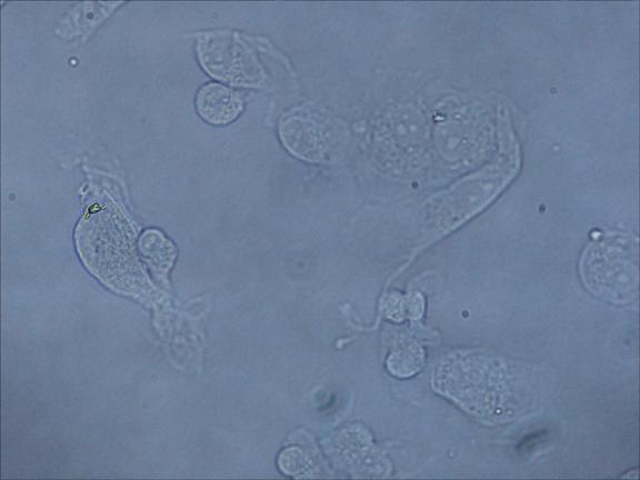 Microscopia in campo chiaro cellule umane non colorate (fissate in