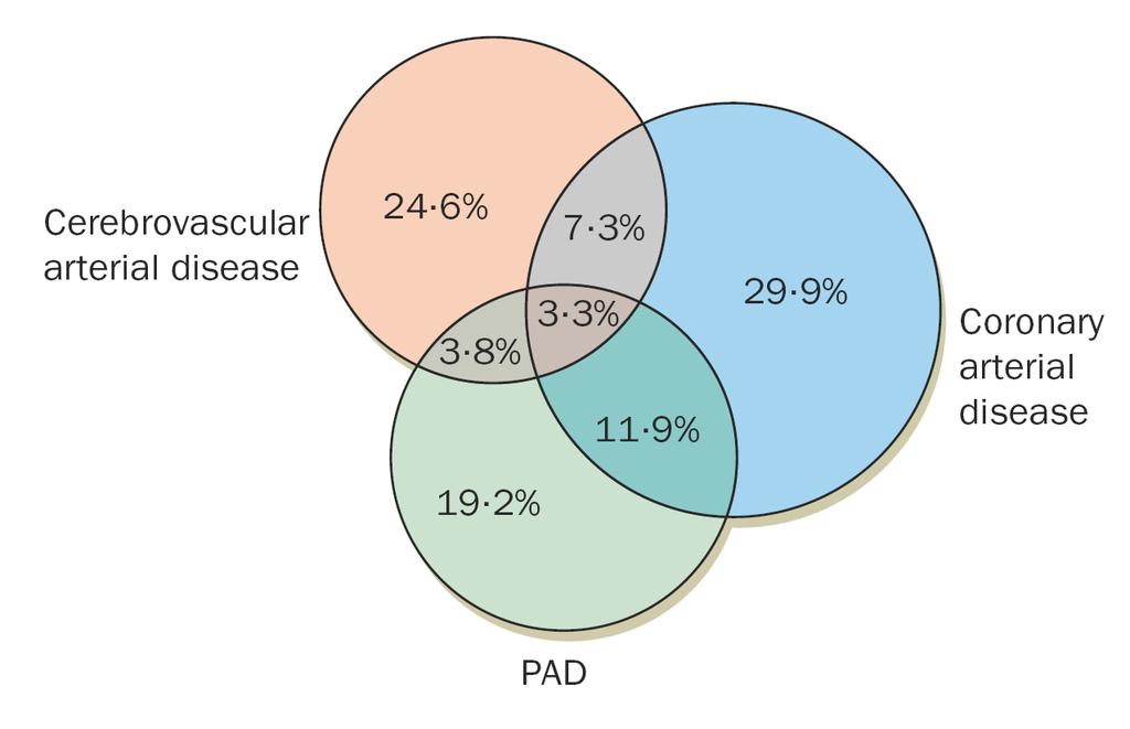 recente Stroke Il 41% dei pazienti con PAD presenta