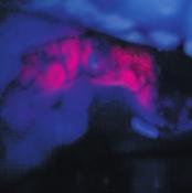 Fluorescenza integrata Fluorescenza neurovascolare Lo studio della microscopia in fluorescenza ha una