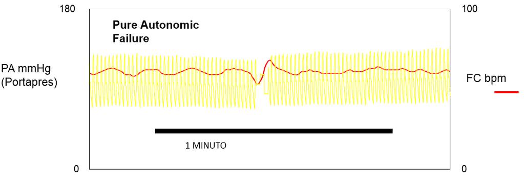 allo stress. Il paziente è mantenuto in clinostatismo a riposo per almeno 2 minuti o per il tempo necessario affinché FC e PA tornino a valori basali.