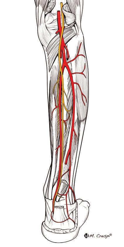 1 2 5 3 4 3 5 6 TAVOLA 67 Nel disegno a sinistra, dopo aver dato origine alla tibiale anteriore, il tronco peroneotibiale si divide in due rami terminali (tibiale posteriore e peroniera).