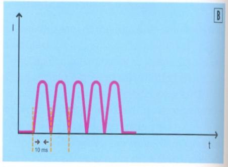 Monofase: tempo attivo 10ms, pausa 10ms, frequenza 50hz analgesia tardiva Difase: tempo