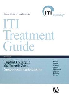 Per ulteriori informazioni sulle procedure chirurgiche nei casi relativi a siti di rilevanza estetica, consultare le seguenti pubblicazioni scientifiche: ITI Consensus Paper Buser D./ Martin W.