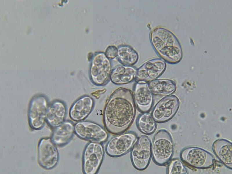 Protozoi RIPRODUZIONE ASESSUATA Sporogonia: Scissione multipla o sporulazione Al termine di queste divisioni all'interno della oociste si trovano 4 sporoblasti ognuno formato da 1 nucleo e rispettivo