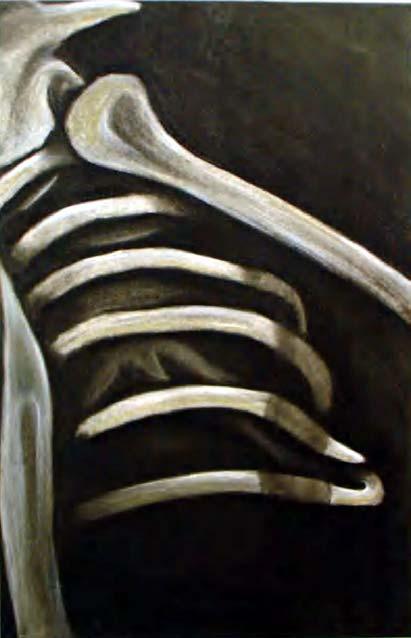 L osteoporosi L osteoporosi è una malattia del sistema