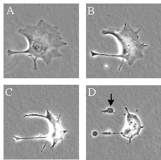 Corpi apoptotici Apoptosi = dal