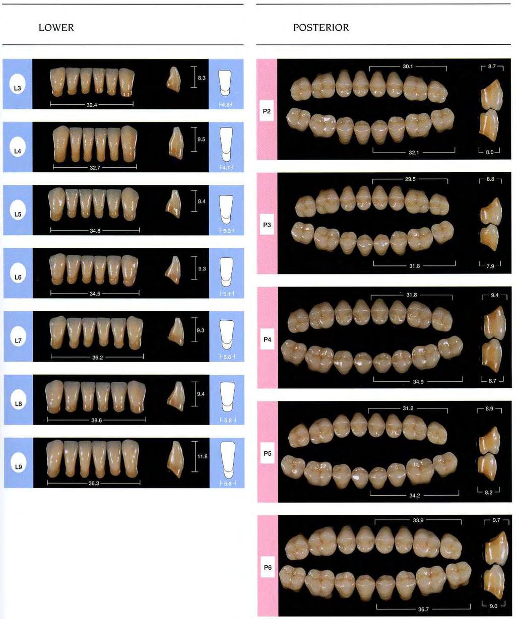 Enigma denti Anteriori