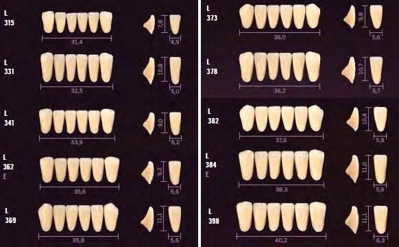 Denti anteriori Mondial 6