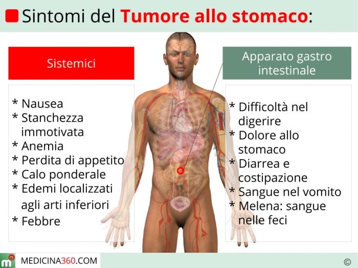 Carcinoma dello stomaco Diagnosi clinica: