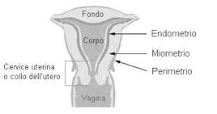 Carcinoma del corpo dell utero Sintomi: sanguinamento vaginale anomalo,
