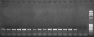 Amplificazione 16S rdna-pcr del DNA totale estratto dai campioni in esame di Ancona (18.10.