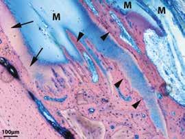 mineralizzazione che si evolve in ossificazione.